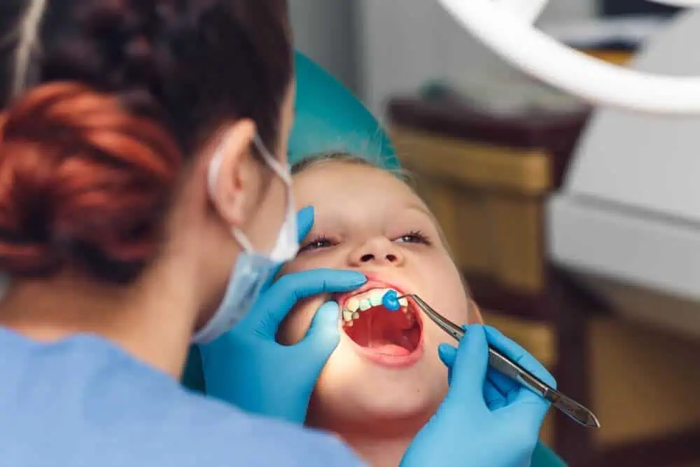 A dental hygienist applying fluoride to a child’s teeth.